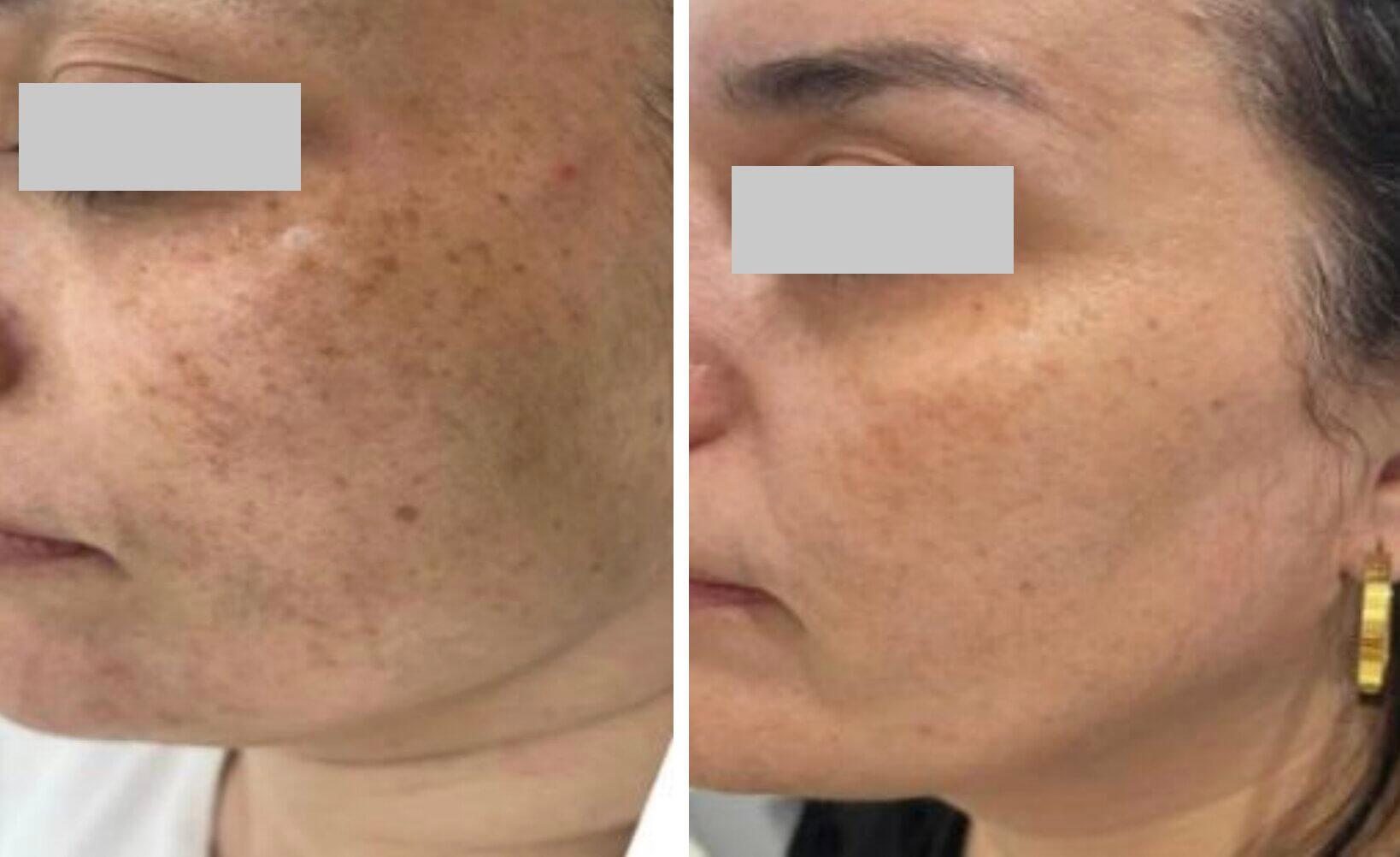  | Klinika Mediestetik