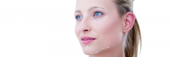 Facelift and neck lift