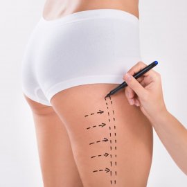 Mommy Makeover – Lösung für Mütter nach der Geburt | Klinika Mediestetik