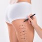 Mommy Makeover – solution for mothers after childbirth | Klinika Mediestetik
