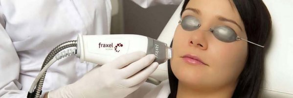 Verjüngung von der Haut im Gesicht mit dem Fraktionslaser Fraxel | Klinika Mediestetik