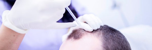 DANN Therapie bei dem Haarverlust RegenPlasma