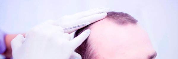 Haaren Mesotherapie | Klinika Mediestetik